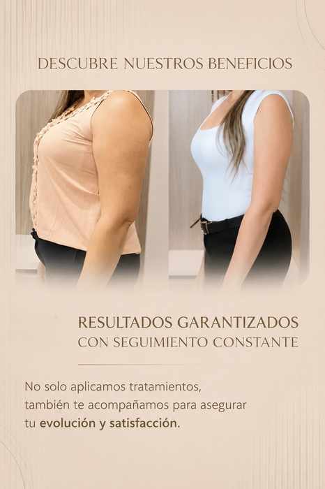 Resultado de remodelación corporal